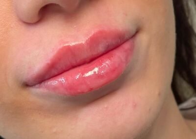 Pert lips